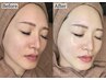 移転CP☆ご褒美贅沢ララ(顔首)+パック+EMSヘッドスパ☆通常14800円→8980円
