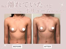 プレフィール(PLEAFEEL)の雰囲気（背中、肩、デコルテをほぐすことにより、バストを元の位置へ！）