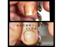 ネイルフライガールの雰囲気（巻き爪専用ジェルでの巻き爪ケア☆有資格者が行います2本6600円）