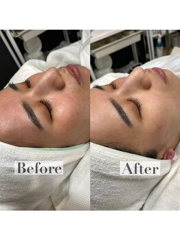 アイサロン ラソ(eye salon lazo)/WAXXXX