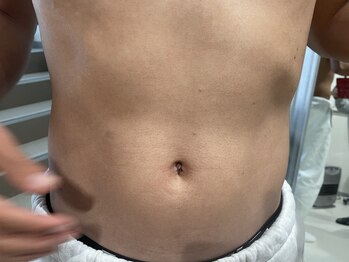 アスティ(Asti)/お腹・おへそまわり