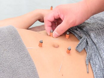 しんのう鍼灸院/鍼灸全身施術