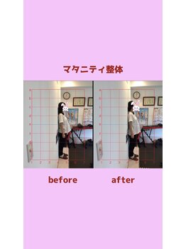 心斎橋長堀フェムテック整骨院/妊活 マタニティ 整体 妊活