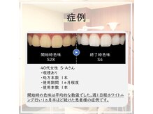エクシアホワイトニング 戸田公園店の雰囲気（強力効果のジェル使用◎ホワイトニングデビューの方も大満足☆）