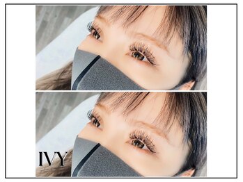 アイビー(IVY)/バインドロック100束