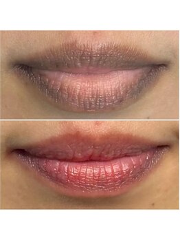 ルビー 新宿(Ruby)/ローマピンク