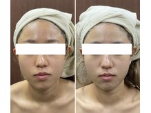 メイス 福井店(MEIS)/お客様Before、After