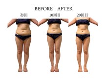 ヨサパーク サノン(YOSA PARK Sanon)/2か月コースの効果