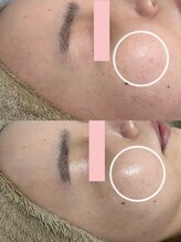 ビビィ(Bibiy)/クリスティーナ/アンストレス