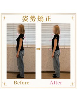 にしやま整骨院の写真/全身の歪みを改善し、体の不調を改善♪猫背・OX脚・Ｘ脚でお悩みの方にもオススメ♪肩こりや腰痛の改善にも