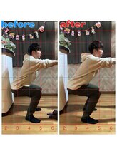 春日部コアラ整体院/Before→After(スクワット動作)