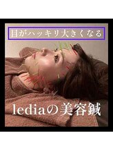 ルディア 堀江店(ledia)/眼精疲労にも効くのが美容鍼