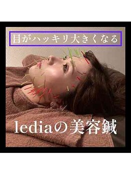 ルディア 堀江店(ledia)/眼精疲労にも効くのが美容鍼