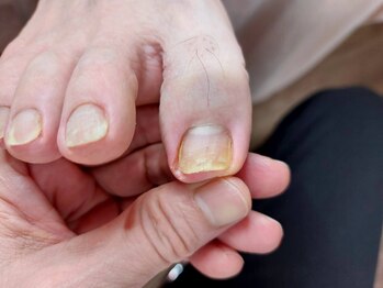 爪切り屋 足楽/40代男性その３