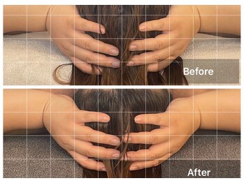 ステッラ(STELLA☆)/脳洗浄　Before/After