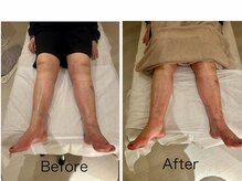 チル アンド リラックス(Chill and Relax)/リフレクソロジーでポカポカ