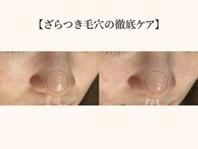 ドリームスパ 武蔵小杉店(DREAM SPA)/毛穴吸引＋水光ツヤ肌パック