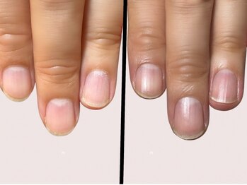 エラン(elan)の写真/Open記念価格でご提供（￥8800）深爪・薄い爪などコンプレックス解消◎自爪育成で“ありのままの美爪”へ。