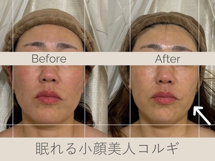 セレソル(CERESOL)の写真