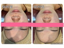 エステティック レイビス 銀座店(RAYVIS)/