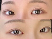 イーズ(ease.)/ラッシュリフト