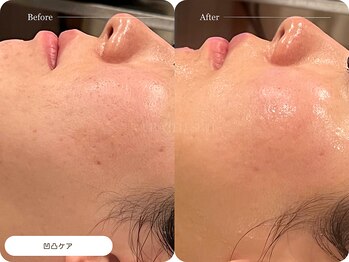 キュレイテッドスキン(CURATED SKIN)/