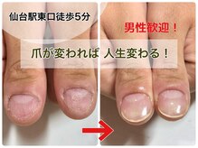 深爪で悩める男性の方にも多くご利用いただいております。