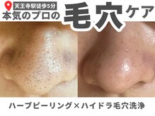 アワピール 天王寺店(AWA PEELL)の雰囲気（贅沢に40種類以上の美容液で毛穴を洗う!最新毛穴洗浄で毛穴レス!）