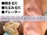 【開き毛穴改善☆毛穴レス】ハーブピーリング(剥離無し)11000円→