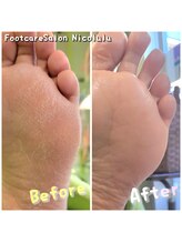ニコルル 大阪天満店(Nicolulu)/足裏つるつるの素足美人へ
