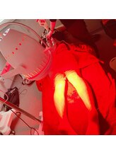 サボテン/冷え性