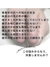 アリエ(allie)/深爪矯正無料カウンセリング