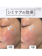 リスキン(Re:Skin)/