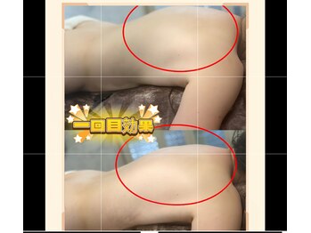 ドクタースタイル(Dr.style)/スッキリ感が違う☆彡