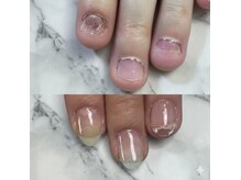 ネイルホーラー(Nail HAULER)の雰囲気(深爪 ちび爪 巻き爪etc... お爪のお悩みご相談ください♪)