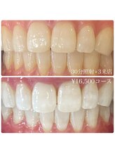 ホワイトニングルーム 横浜店(Whitening Room)/セルフホワイトニング/横浜
