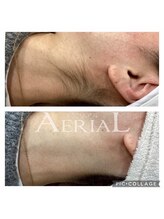 エアリアル 筑紫野店/実は見られてる、えりあし！