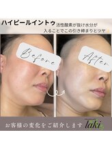 リラクゼーションサロン ラキ(laki)/ハイピールイントゥー