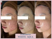 ホワイトアクア 浜松店(WHITE AQUA)の雰囲気（全国約70店舗展開中!安心安全の丁寧なカウンセリング&施術）