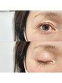 アイプラス(eye+) ナチュラルブラウンカラーで垢抜けまつ毛**