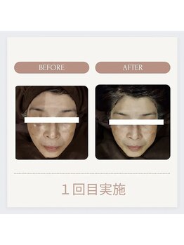 美々庵/光フェイシャル◆