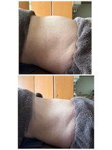 アヤズ サロン(AYA's SALON)/腸もみ