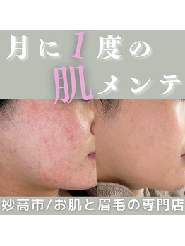 マール(MARL.)/お悩み改善でほめられ肌♪