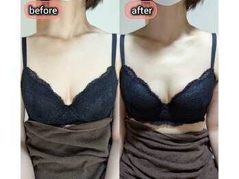 スノードロップ(snowdrop)/バストアップ　1回での変化