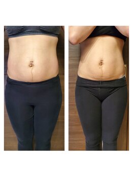 ルピナス(Lupinus.)/ビフォーアフター写真★