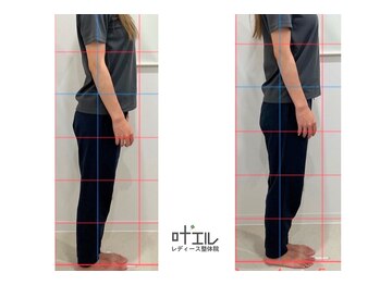 叶'エル 本町 心斎橋院/姿勢改善　骨盤矯正