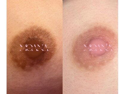 モアナ(MOANA)の写真