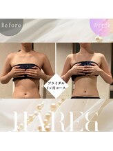 ハレアンド(Hare&)/20代後半ブライダル1ヶ月コース