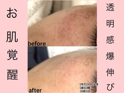 ウェリナ(Welina)の写真