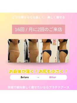 プラチナアース 守谷店(Platinum earth)/痩身ビフォーアフター